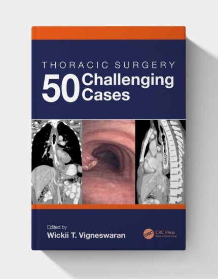 Thoracic Surgery: 50 Challenging cases (1st Edition)